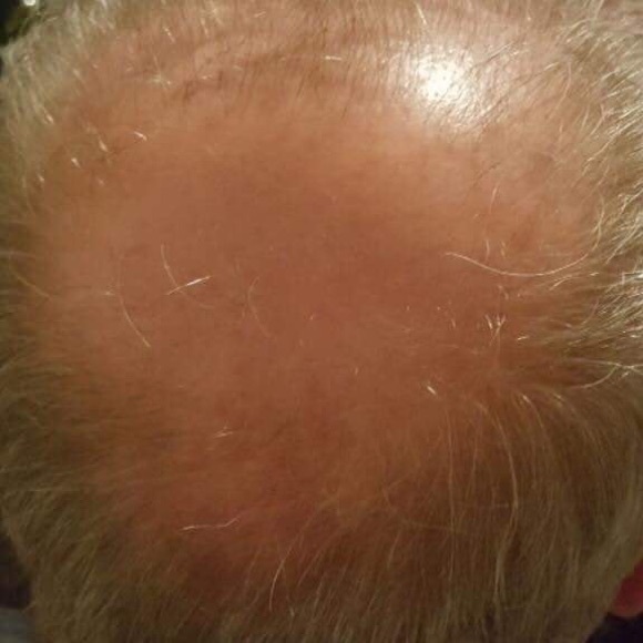 Sorduse huile capillaire pour cheveux - Picture 3 of 6